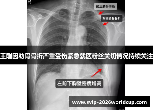 王刚因肋骨骨折严重受伤紧急就医粉丝关切情况持续关注